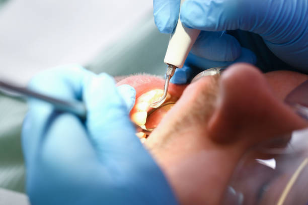 Best Pediatric Emergency Dentist in Park City, IL