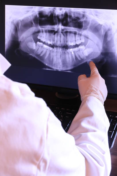 Best Emergency Dental Care for Abscessed Tooth in Park City, IL