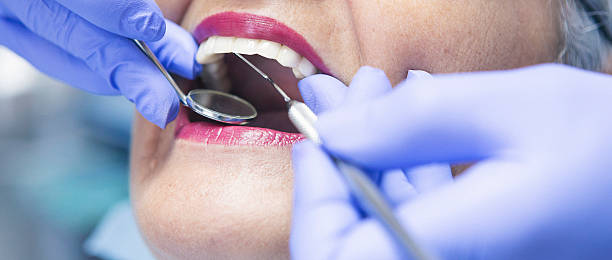 Best Urgent Dental Care for Toothache in Park City, IL